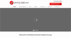 Desktop Screenshot of brisbanedentalimplantgroup.com.au